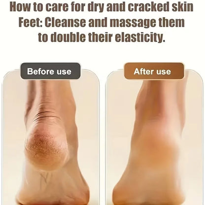 VelvetStep™ Electric Callus Remover